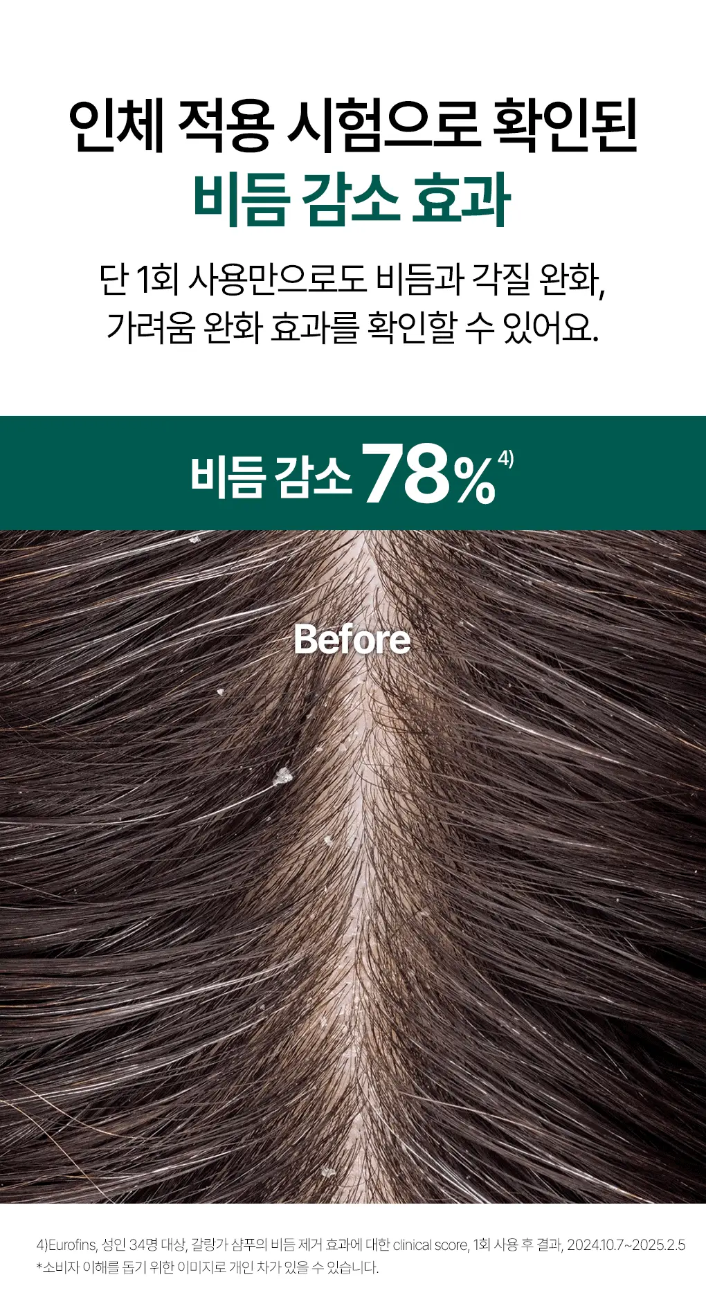 [지루성두피&가려움케어] 클로란 갈랑가 진저 비듬샴푸400ml 상세페이지 13